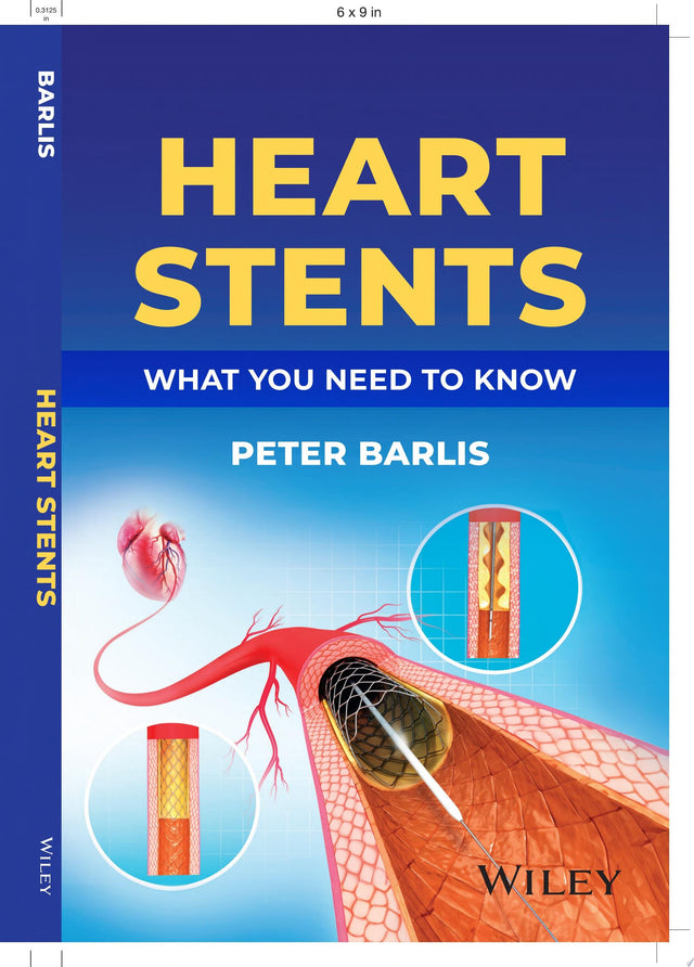 Heart Stents
