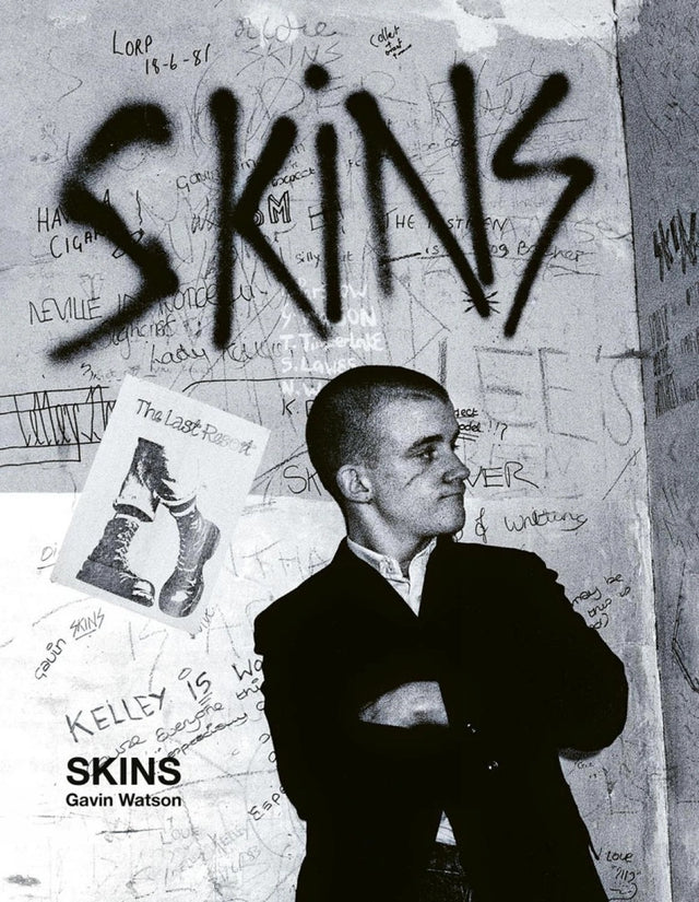 Skins - Special Edition