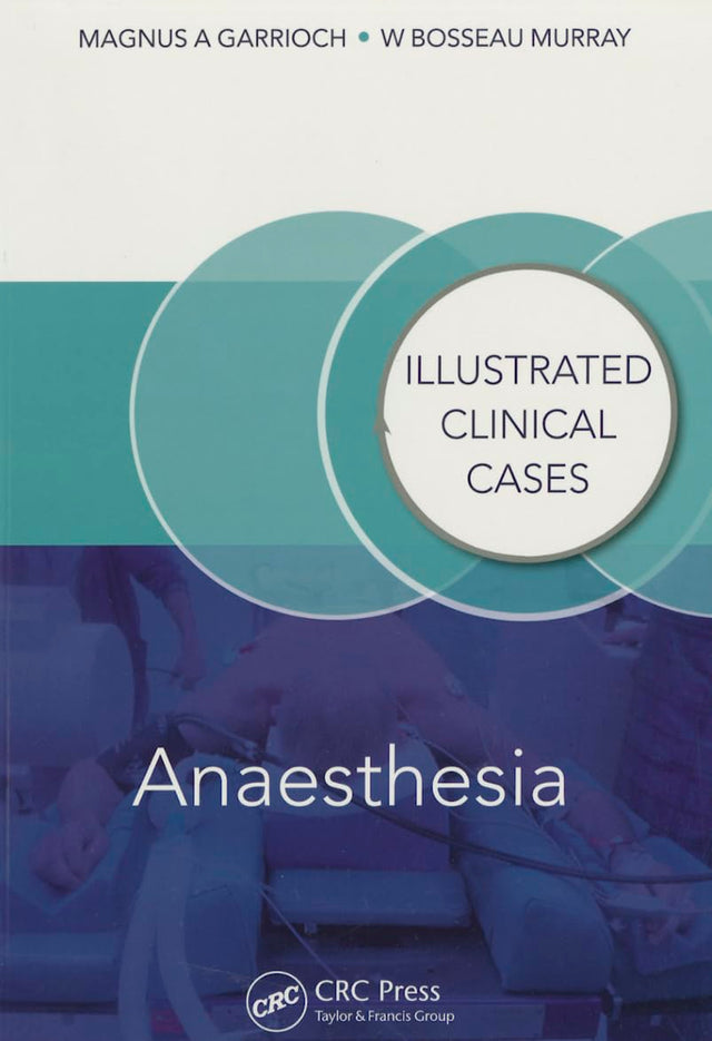 Anaesthesia