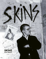 Skins - Special Edition
