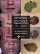 Differential Diagnosis in Dermatology