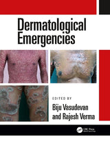 Dermatological Emergencies