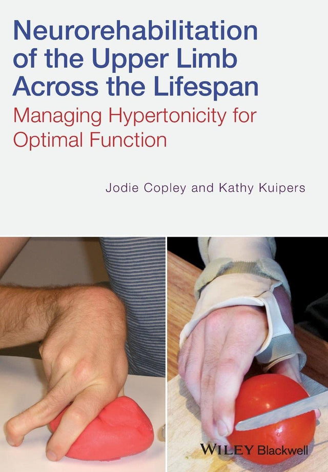 Neurorehabilitation of the Upper Limb Across the Lifespan
