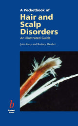A Pocketbook of Hair and Scalp Disorders