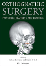 Orthognathic Surgery