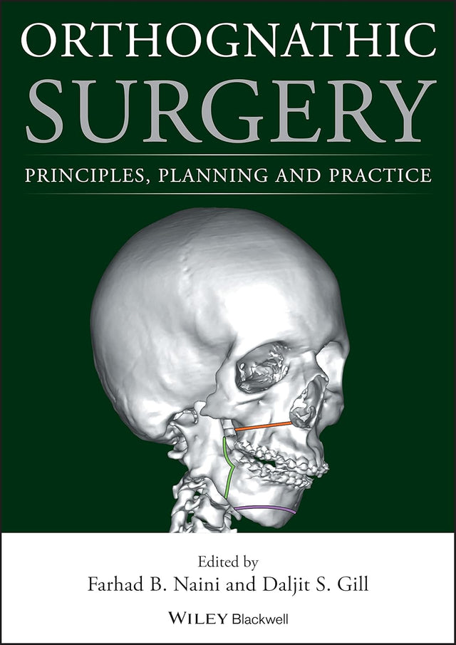 Orthognathic Surgery