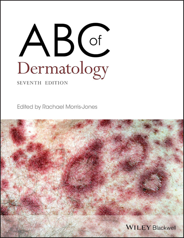 ABC of Dermatology