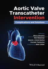 Aortic Valve Transcatheter Intervention