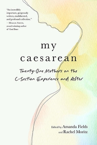 My Caesarean