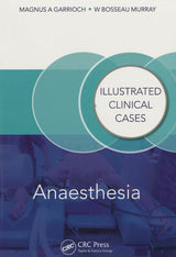 Anaesthesia