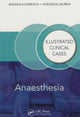 Anaesthesia