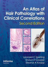 An Atlas of Hair Pathology with Clinical Correlations